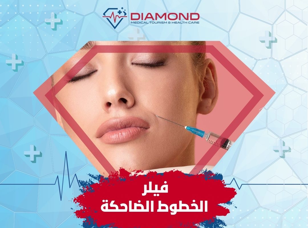 ابر الفيلر في اسطنبول