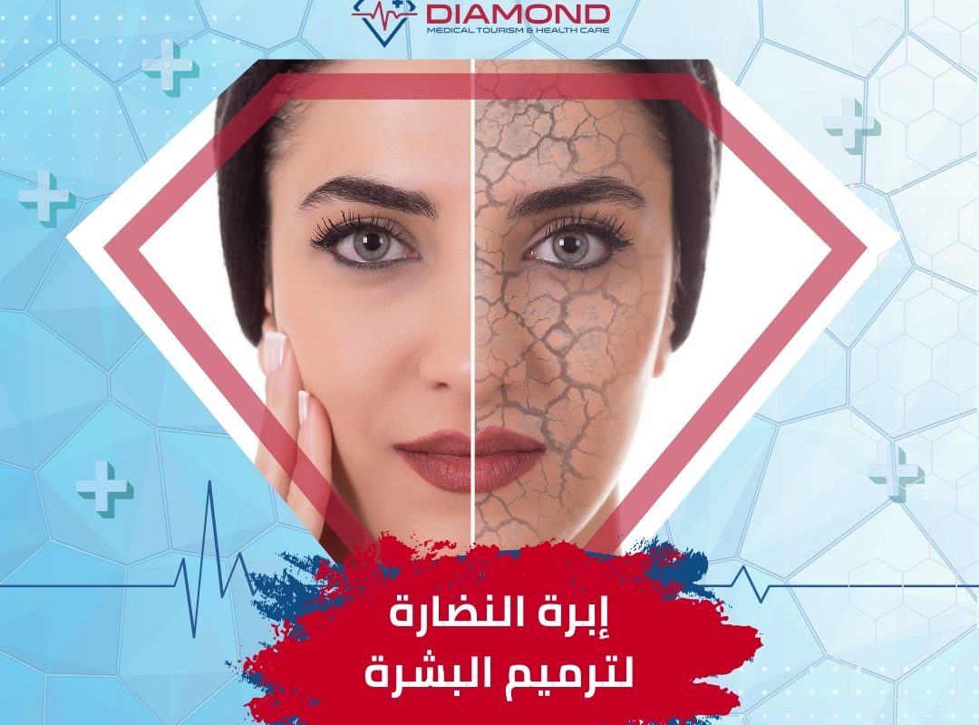 اسعار إبر النضارة في تركيا