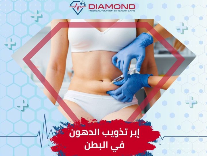 ابر تذويب الدهون في البطن