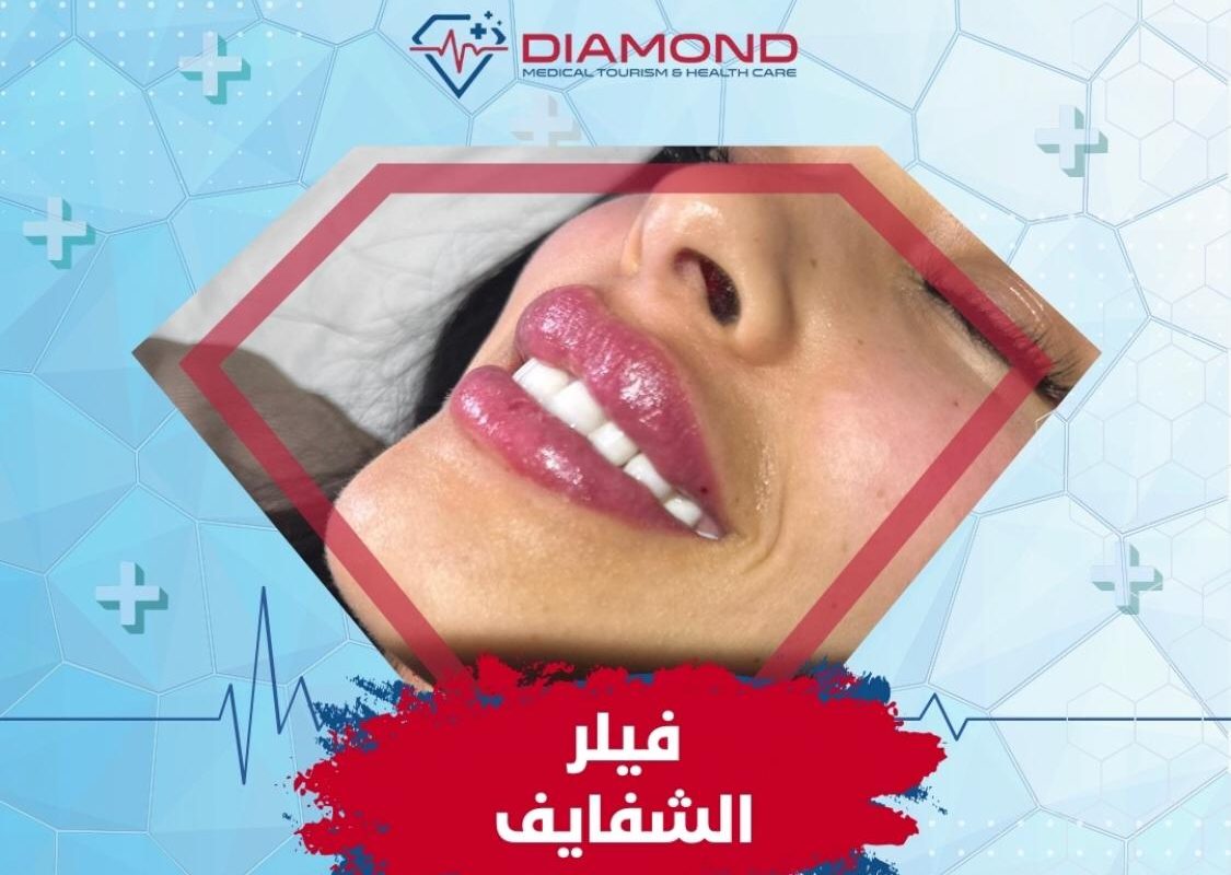 أسباب التورم بعد الفيلر