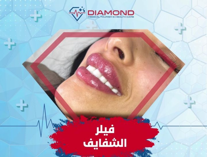 أسباب التورم بعد الفيلر