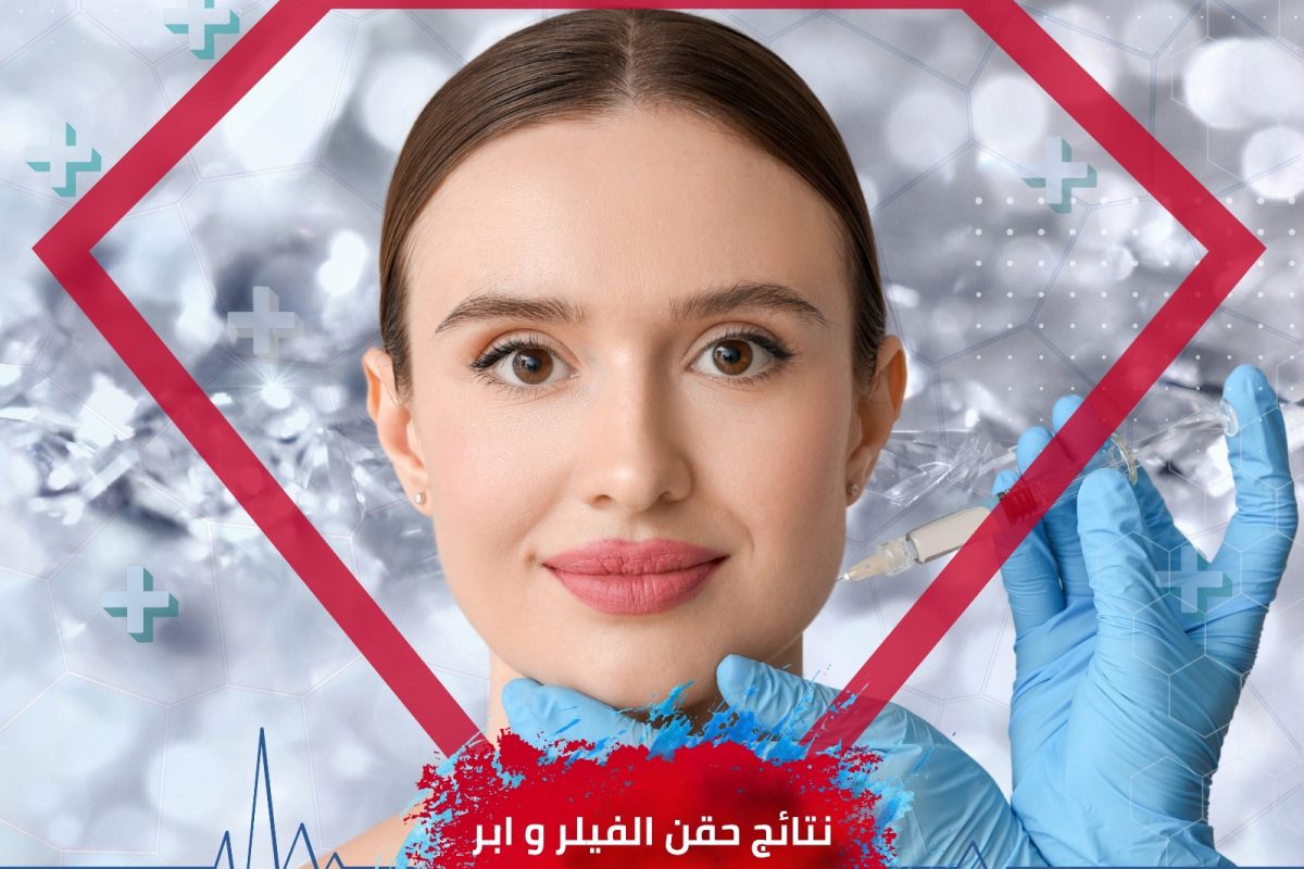 نتائج الفيلر و ابر النضارة