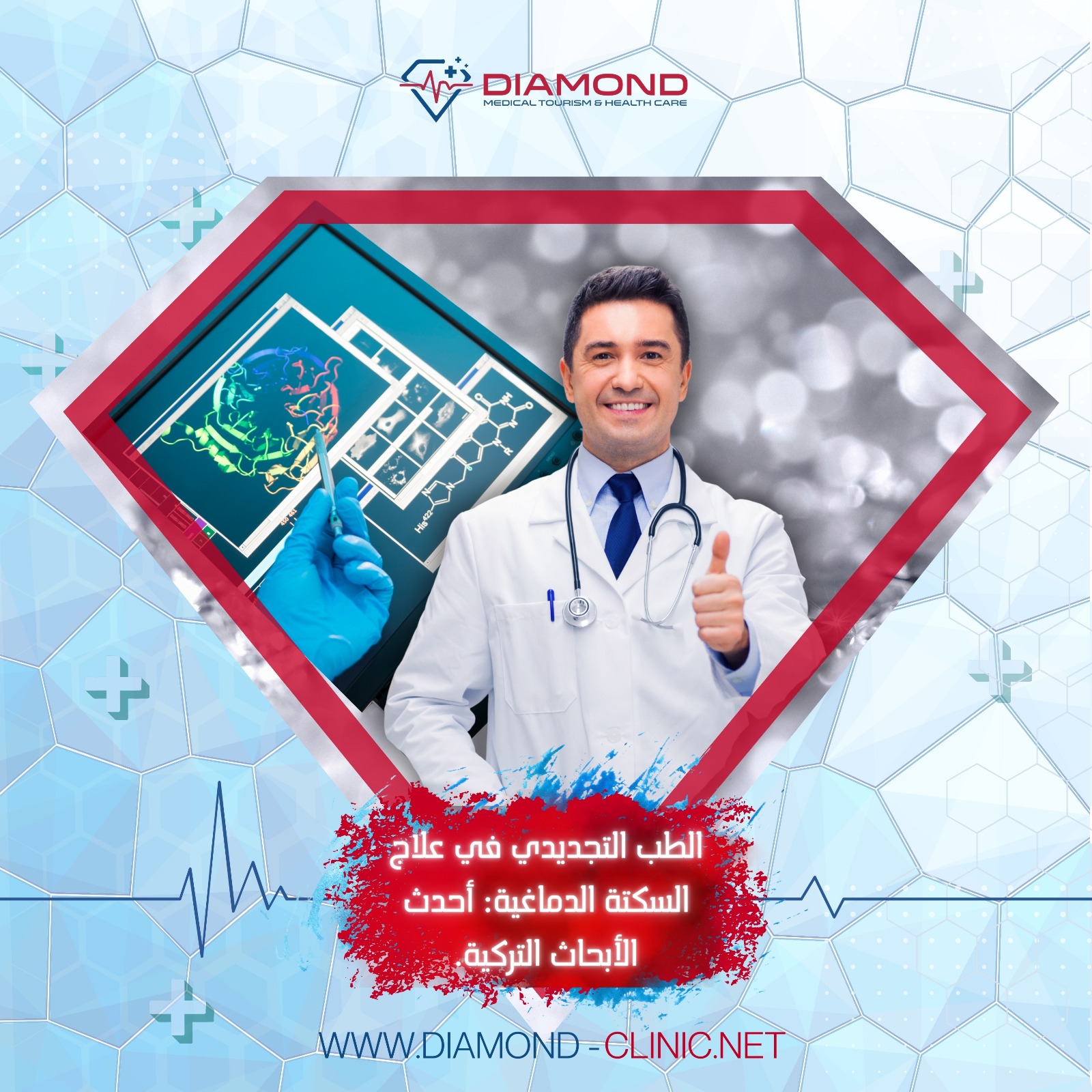 علاج السكتة الدماغية