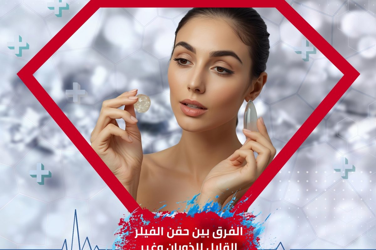 الفرق بين أنواع الفيلر