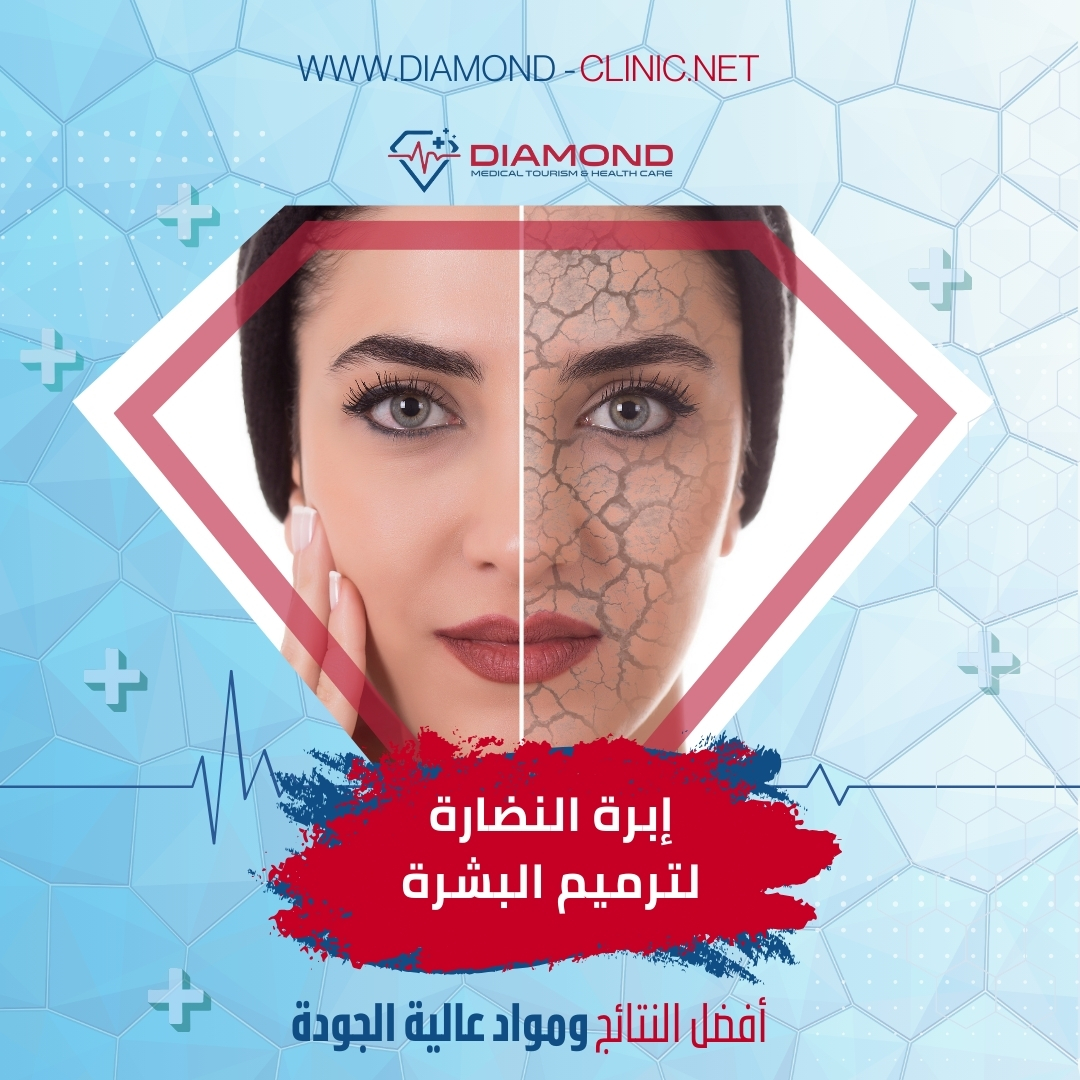 اسعار إبر النضارة في تركيا