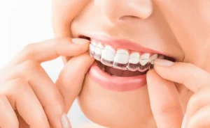  سياحة علاج الأسنان في تركيا 